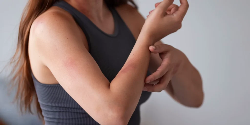 How do I know I have bed bugs